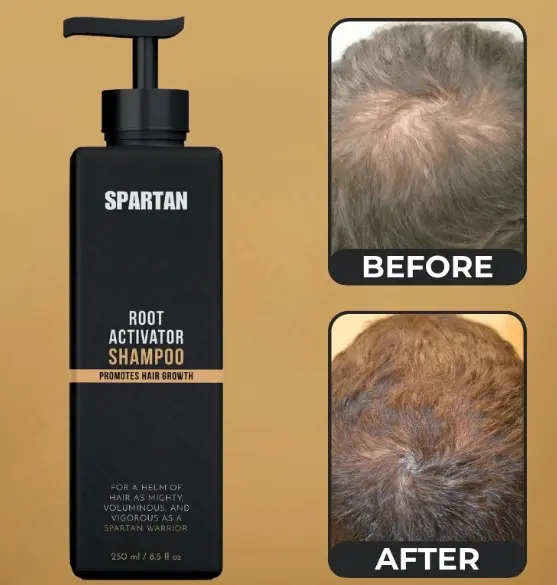 Spartan Root Activator Shampoo with before and after photos showing fuller-looking hair at the crown